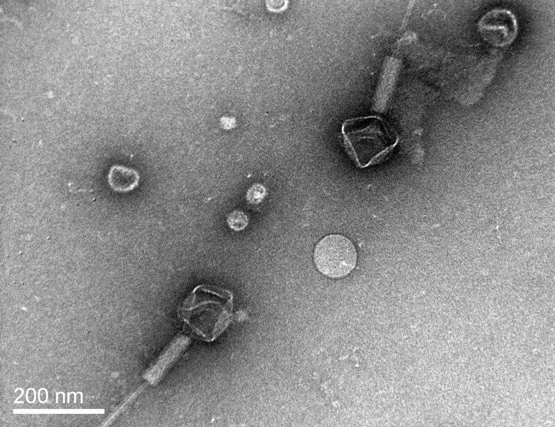 TEM images of bacteriophage